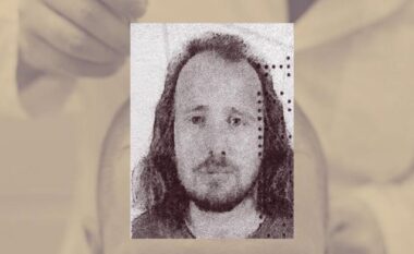 E rëndë në Turqi/ Bëri transplant të flokëve dhe trajtim dentar, humb jetën 36-vjeçari shqiptar