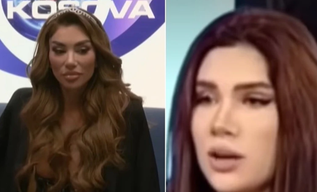 VIDEO  Si dukej Bia Khalifa para ndërhyrjeve në fytyrë  Publikohen fotot para ndryshimeve estetike