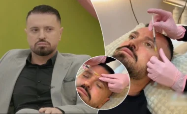 Publikohen pamjet e Labinot Rexhës duke injektuar botoks në fytyrë para se të hynte në Big Brother VIP Kosova 4