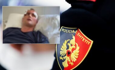 E rëndë në Fier/ I komentoi motrës së tij në Facebook, punonjësi i policisë dhunon babë e bir në Fier