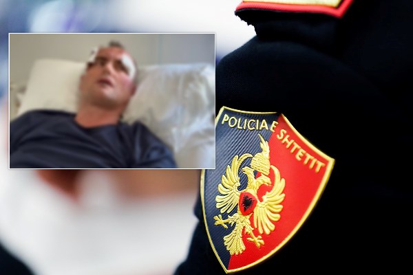 E rëndë në Fier  I komentoi motrës së tij në Facebook  punonjësi i policisë dhunon babë e bir në Fier