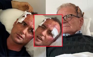 EMRAT/ “Pse i bëre like?, emigranti 46-vjeçar dhe babai i tij rrihet nga fqinji në Fier. Polici e dhunoi për komentin në facebook në profilin e motrës