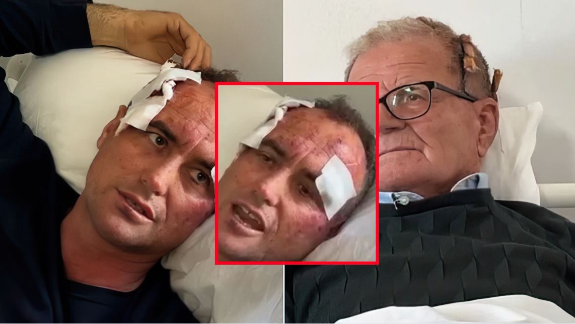 EMRAT/ “Pse i bëre like?, emigranti 46-vjeçar dhe babai i tij rrihet nga fqinji në Fier. Polici e dhunoi për komentin në facebook në profilin e motrës