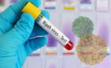 Çfarë është virusi Nipah dhe pse po alarmon botën?