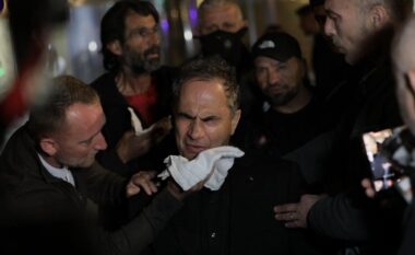 “Të q*** r***, o sh*****”, po na vrisni”, lëndohen deputetët demokratë, Luçiano Boçi niset me urgjencë në spital
