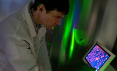 Terapi me qeliza CAR T/ Shkencëtarët drejt një qasjeje të re për trajtimin e sëmundjeve autoimune