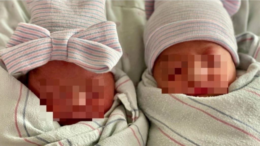 E rëndë në Shkodër/ 27-vjeçarja humb jetën pas lindjes së binjakëve