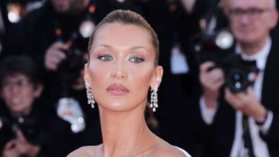 Bella Hadid alarmon fansat me rrëfimin e saj   Kam provuar çdo trajtim  asgjë nuk po më ndihmon 