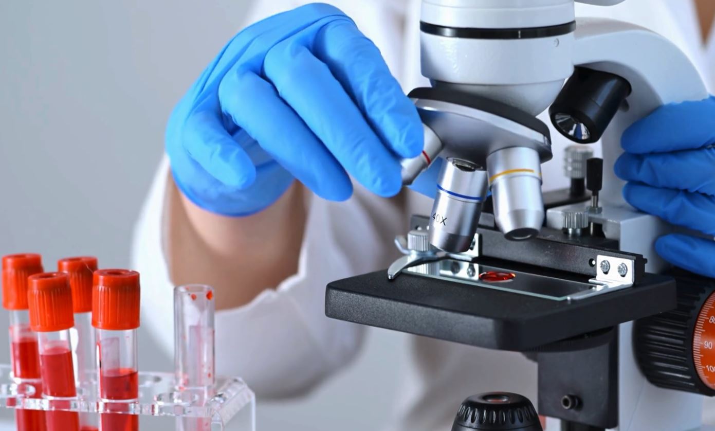 analiza-e-re-e-gjakut-mund-te-shpejtoje-diagnostikimin-e-endometriozes